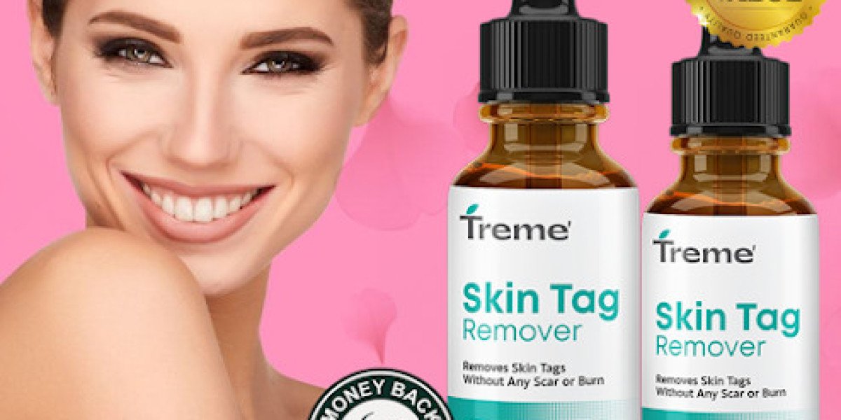 Treme Tag Remover Reviews