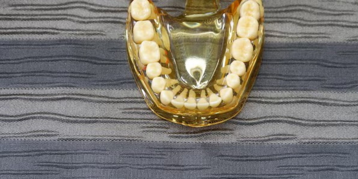 The Timeless Appeal of Gold Dentures