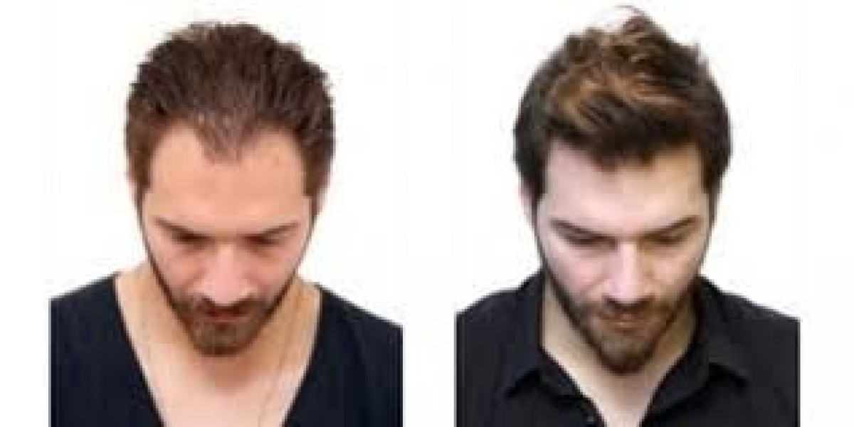 Article Picture