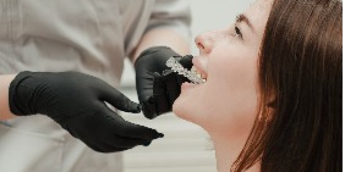 Article Picture