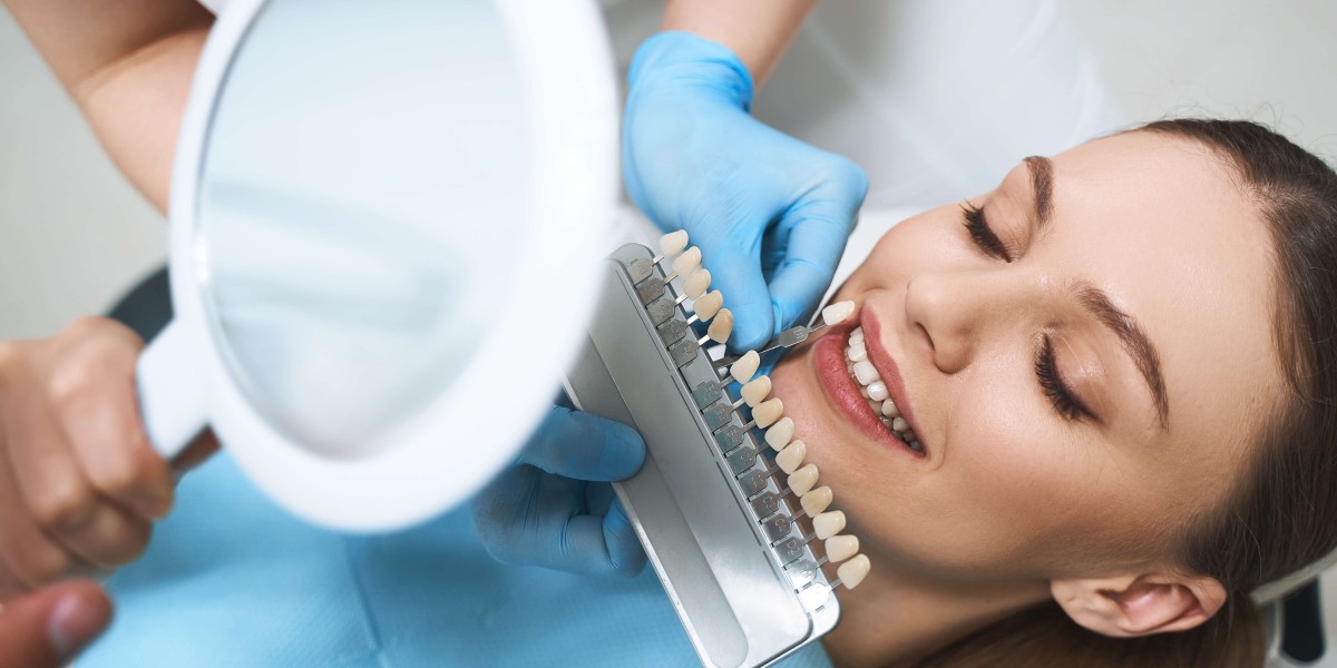 Healthy Gums, Happy Life: Bakersfield's Dental