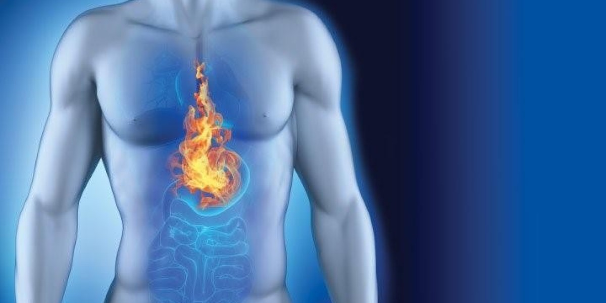 Acidity Every Day? It's Not a Lifestyle Issue