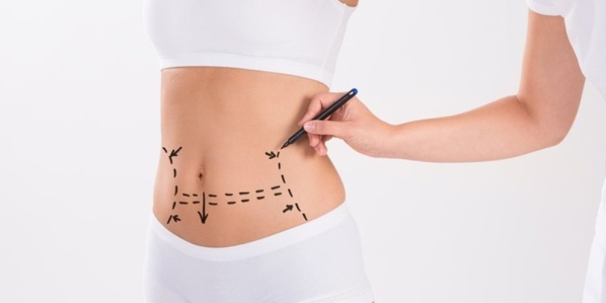 Pre-Tummy Tuck Preparation Tips in Islamabad