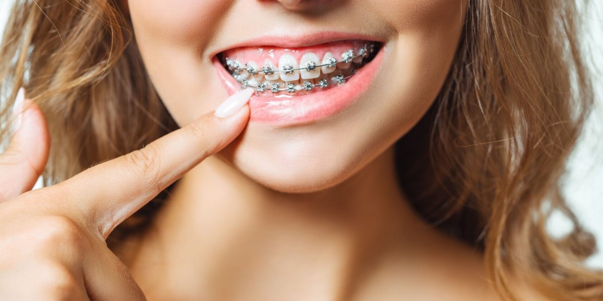 The Science Behind Orthodontic Treatment