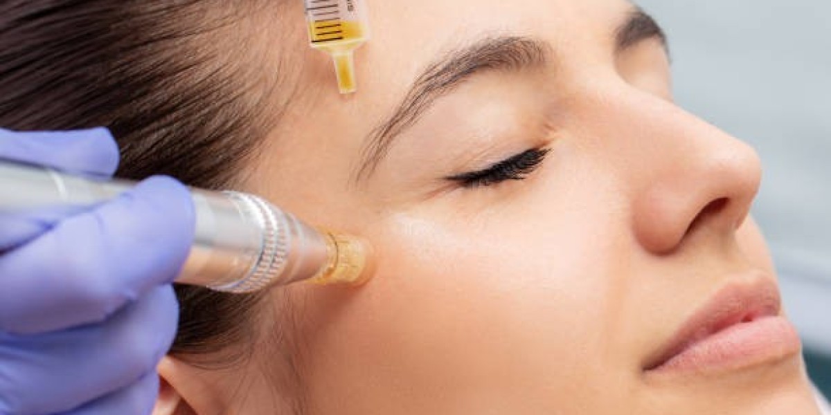 Mesotherapy Dubai: For Glowing Skin