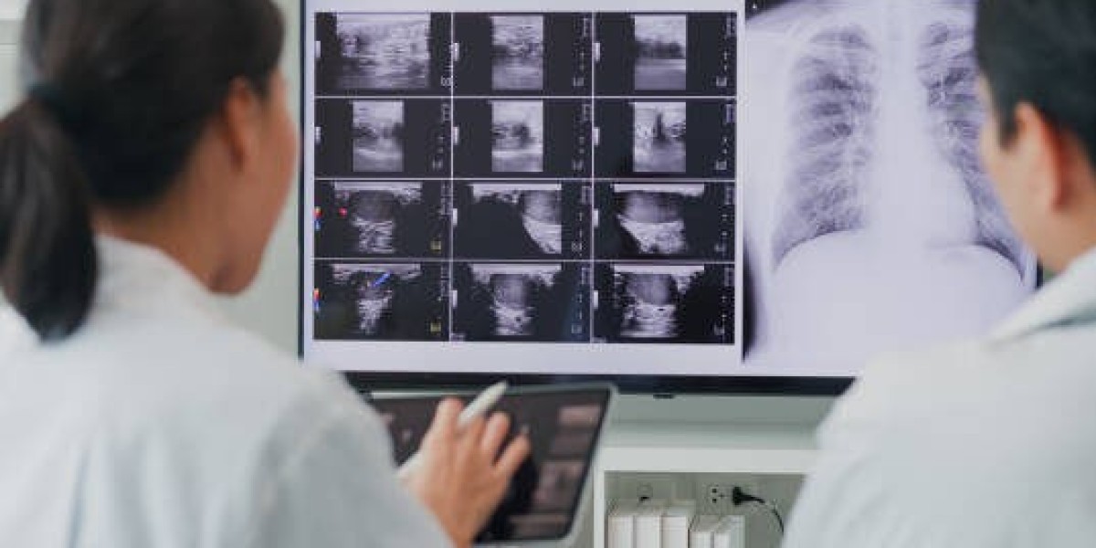 Revolutionizing Spinal Care: Digital X-Ray Chir