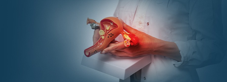 Best Ovarian Cancer Treatment Hospitals in Hyderabad Cover Image