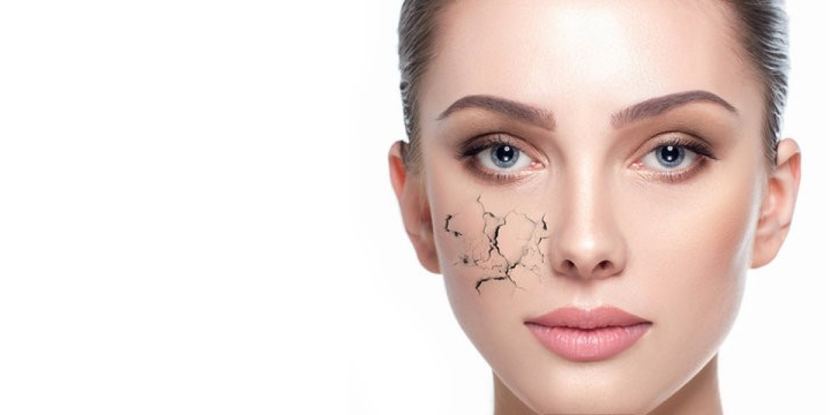 Can Food and Diet Affect Dry Skin?