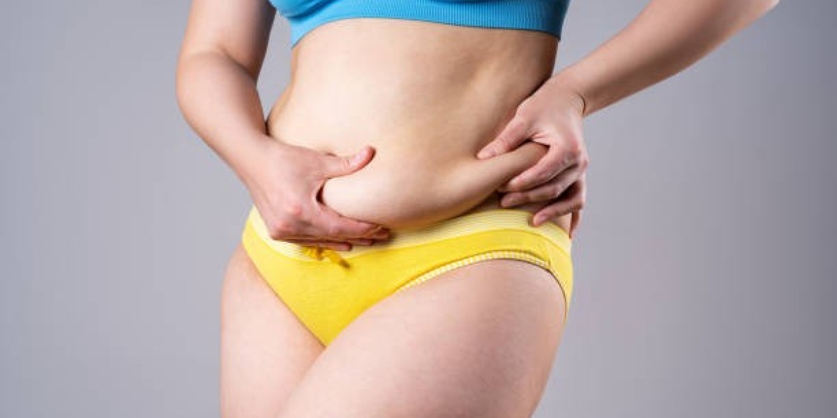 How to Choose a Clinic for Liposuction