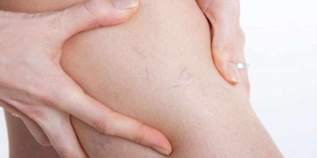 Who should take Venoxil?