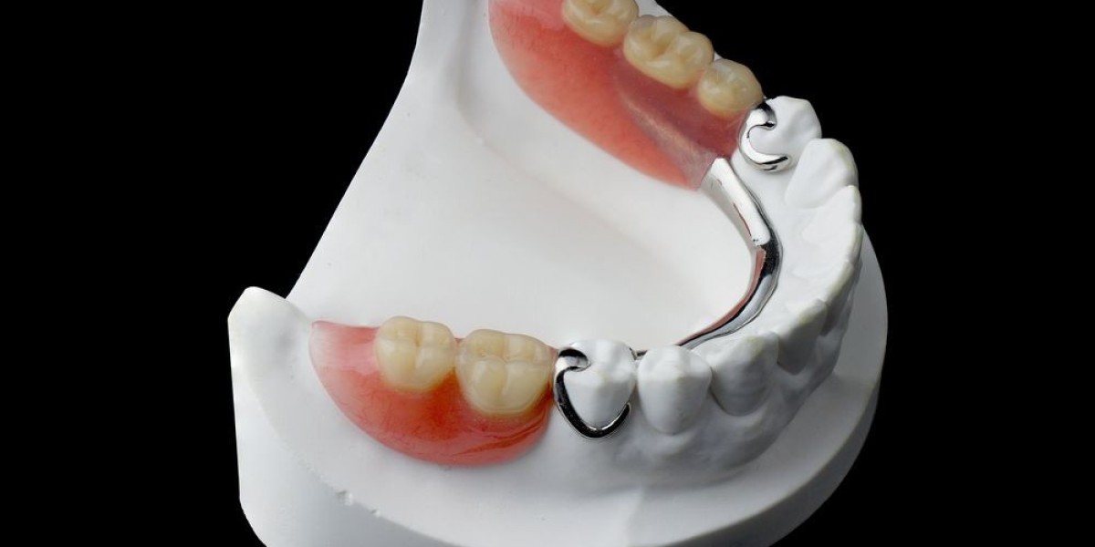 Are Partial Dentures Right for You to Choose?