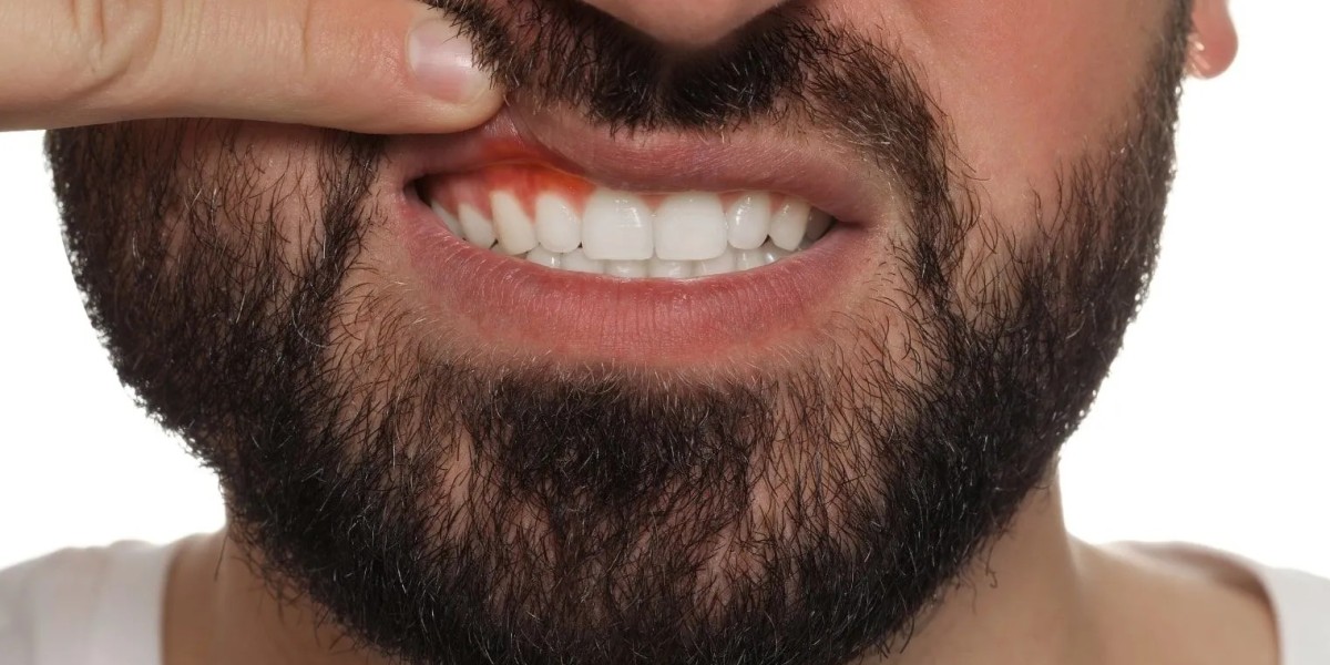 Swollen Jaw or Gums? Get Urgent Dental Care