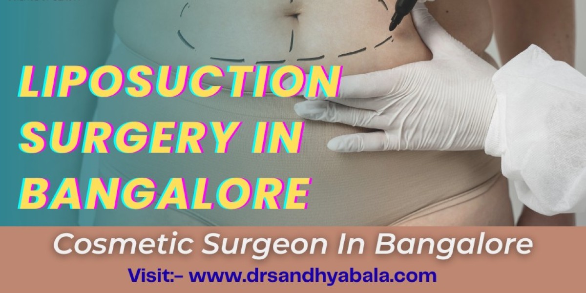 8 Amazing Things About Liposuction Surgery