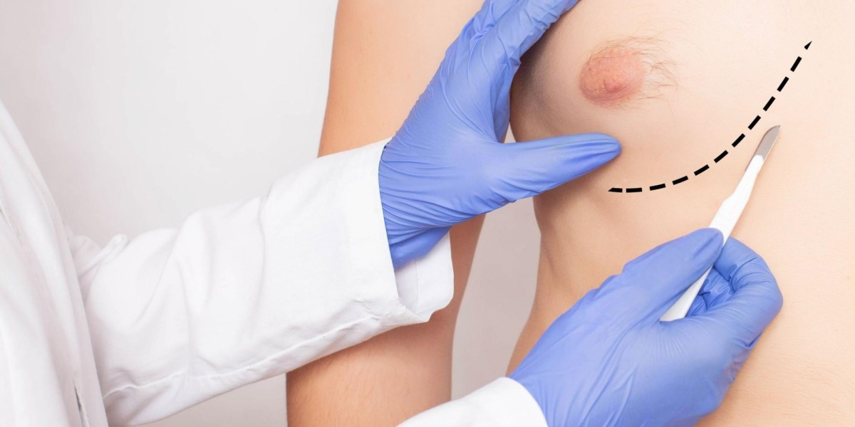 How Safe is Male Breast Reduction Surgery in Is