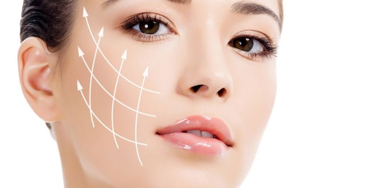 What to Expect After a Thread Lift Procedure in
