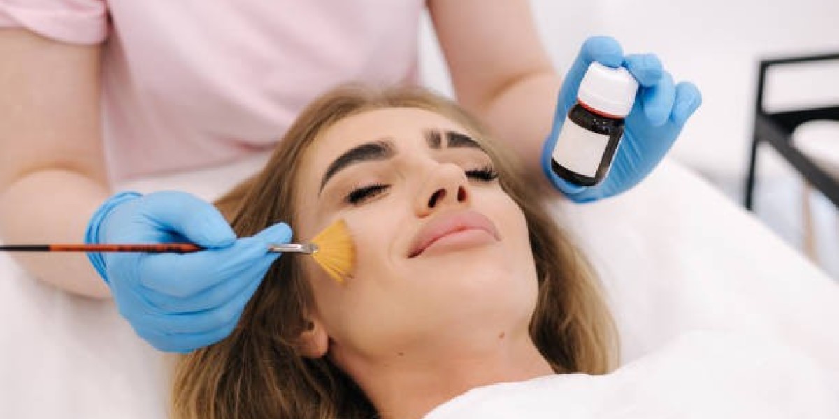 How Chemical Peels in Riyadh Improve Skin Textu