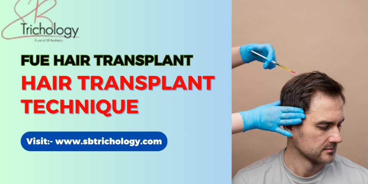 How to Maximize your FUE Hair Transplant Surger
