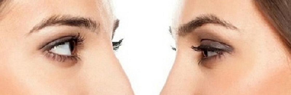 La rinoplastica in Ospedale Cover Image