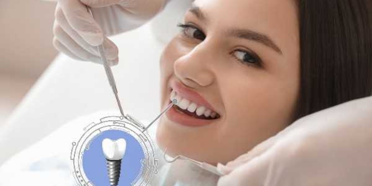 Bridge or Implant? Deciding the Best for You