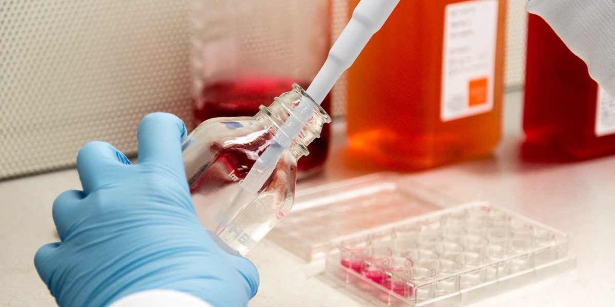 Bioprocess Validation Market: Challenges