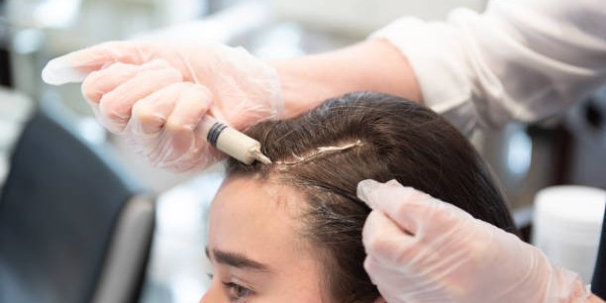 Affordable PRP Hair Treatment Options in Riyadh