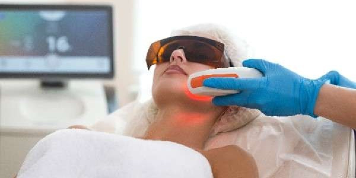 Laser Hair Removal: Is It Really Permanent?