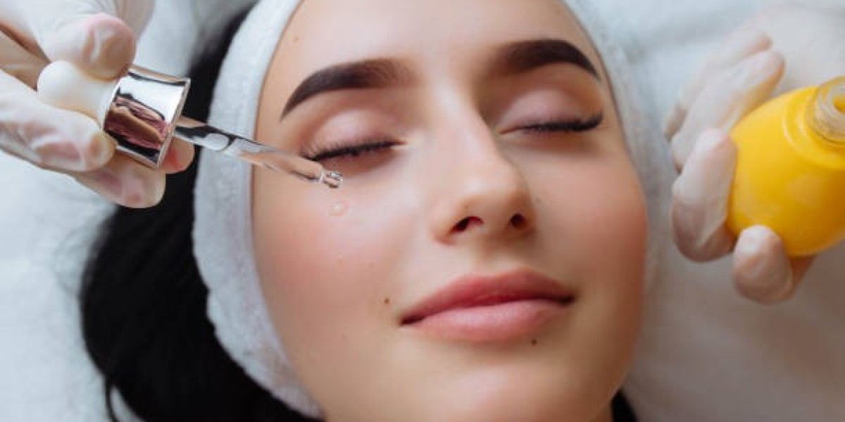 How to Prepare for a Chemical Peel Treatment