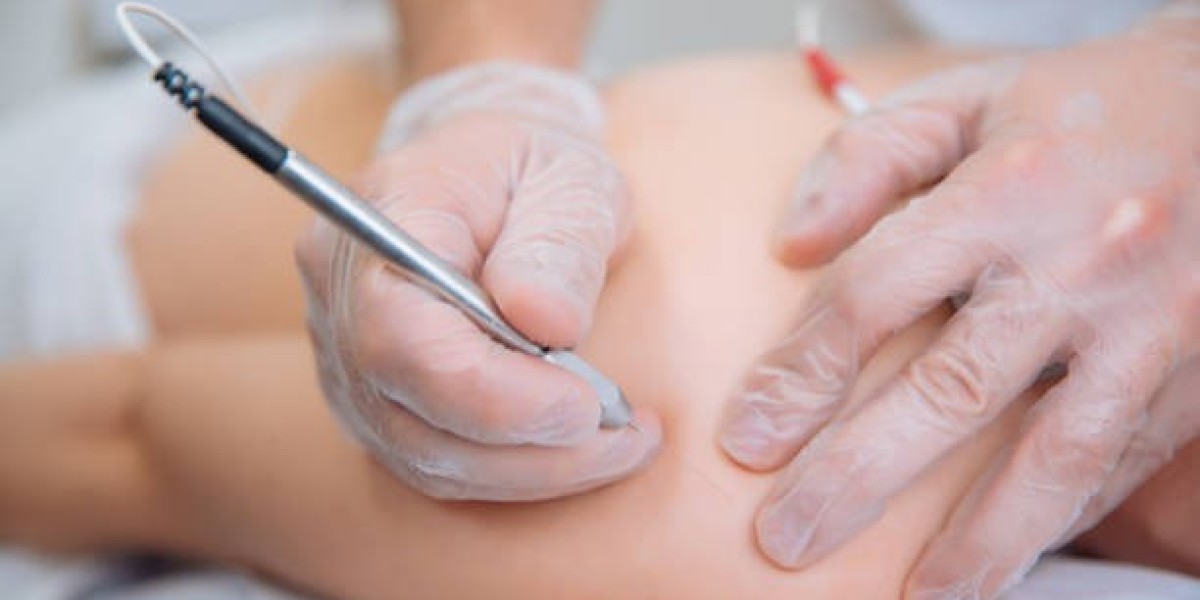 Dubai: Achieve Permanent Hair-Free Skin
