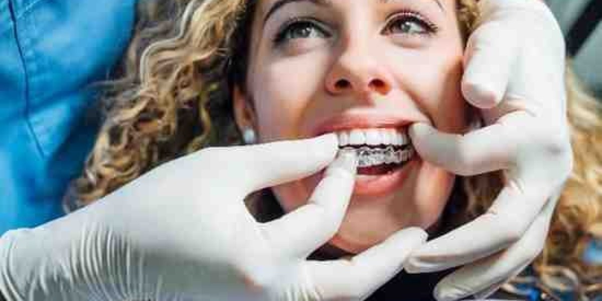Orthodontics Evolved: Invisalign in Ely