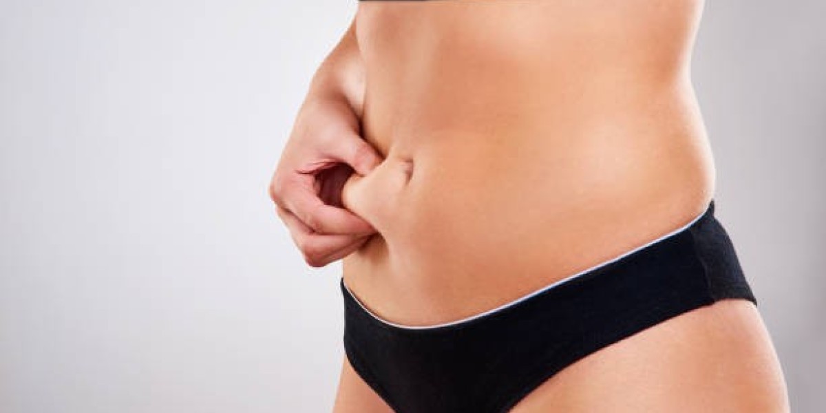 Tummy Tuck in Dubai: Choosing Your Specialist
