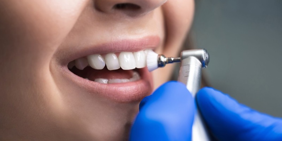 Cost of Dental Cleaning Without Insurance 2025