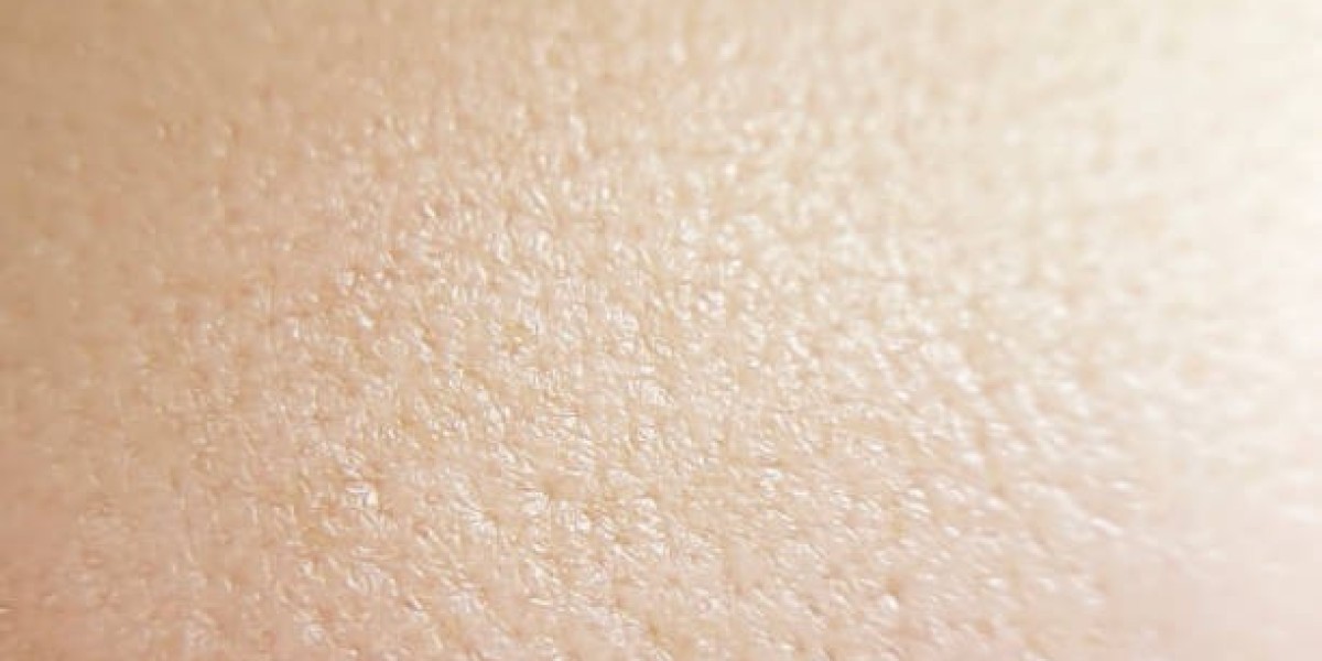 Large Pores Treatment: The Science Behind It