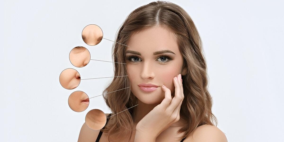 Jawline Contouring with Fillers: Trends in Isla