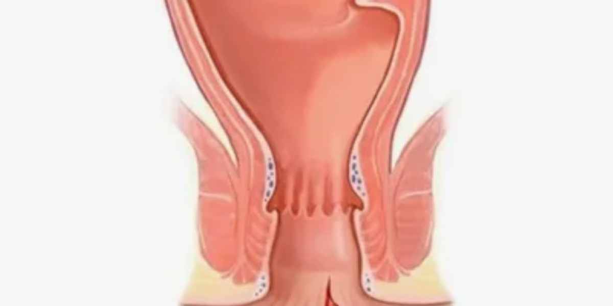 Anal Fissure Treatment Market Overview, Growth,