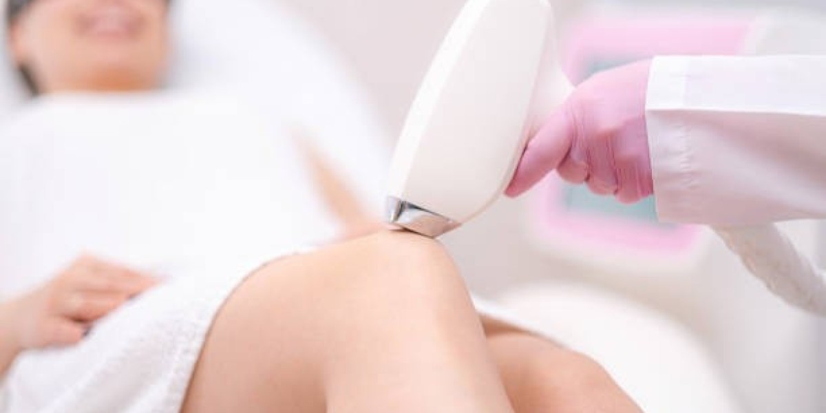 Top FAQs on Laser Hair Removal in Riyadh