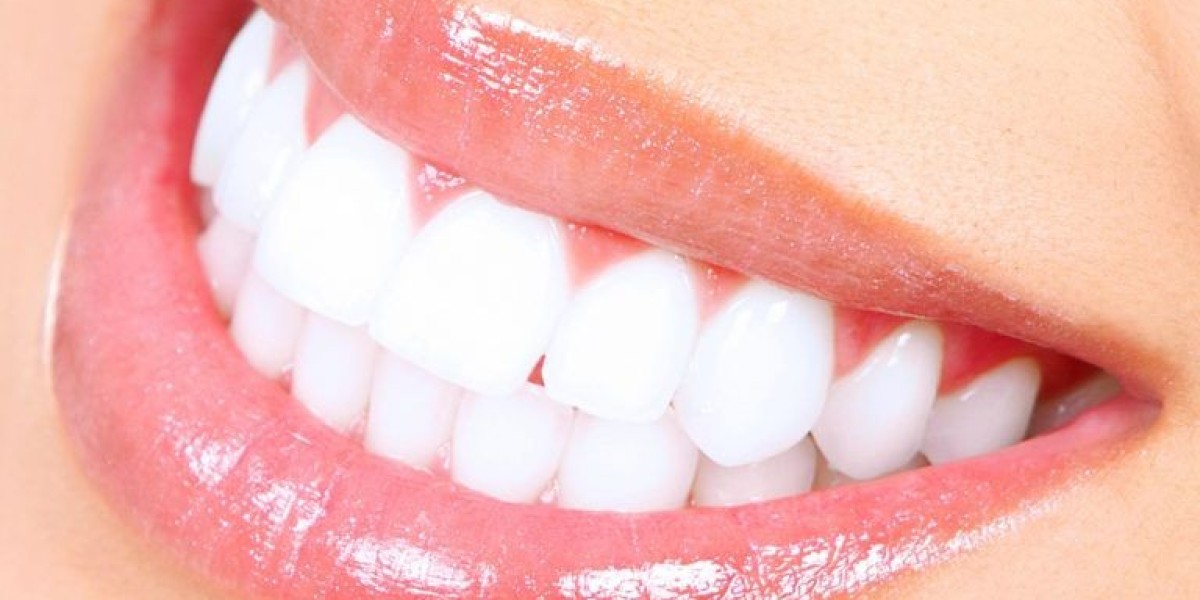 When Should You Reevaluate Teeth Whitening Cost