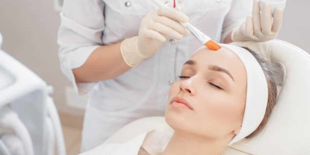 Exploring Different Types of Chemical Peels for
