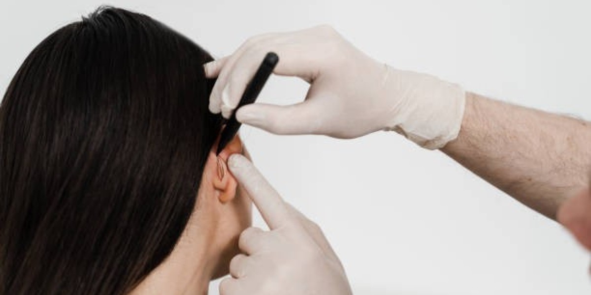 Top Questions to Ask Your Surgeon About