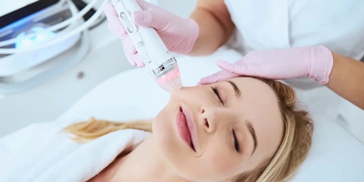 Fractional RF Microneedling Gives Glow Longer