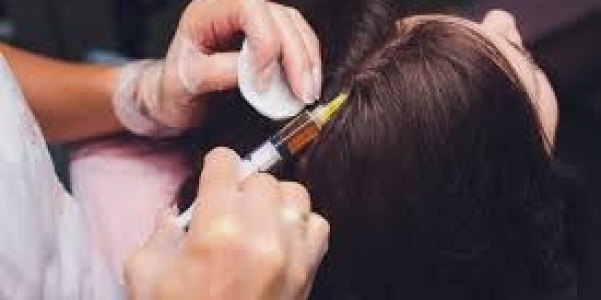 Best PRP Hair Treatment in Islamabad – Natural