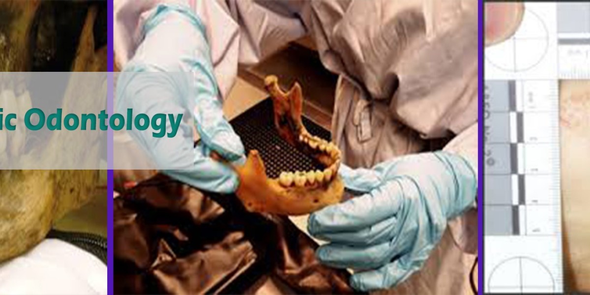 Forensic Odontology by Fondelco – FFSI