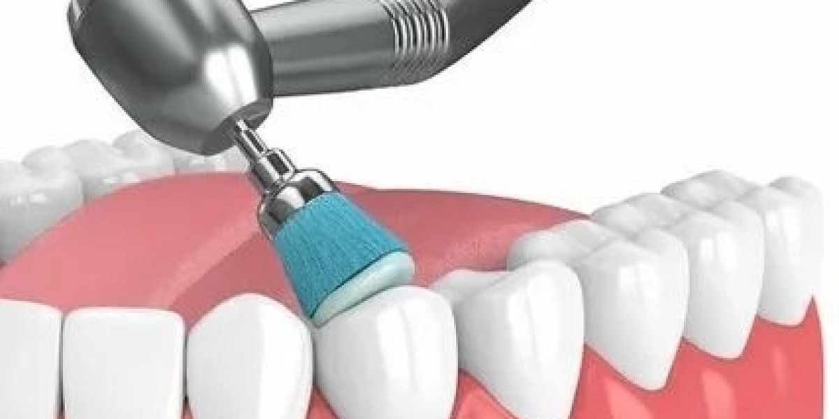 Teeth Cleaning and Polishing in Islamabad – Mai