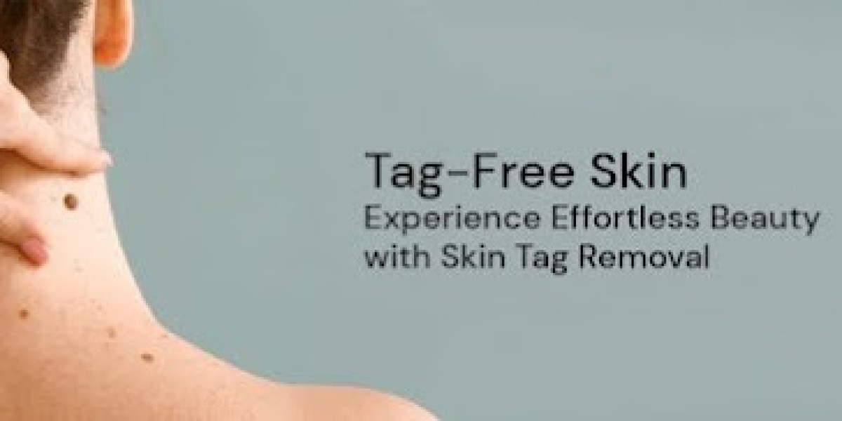 https://www.facebook.com/TagFreeSkinTagRemoverUS