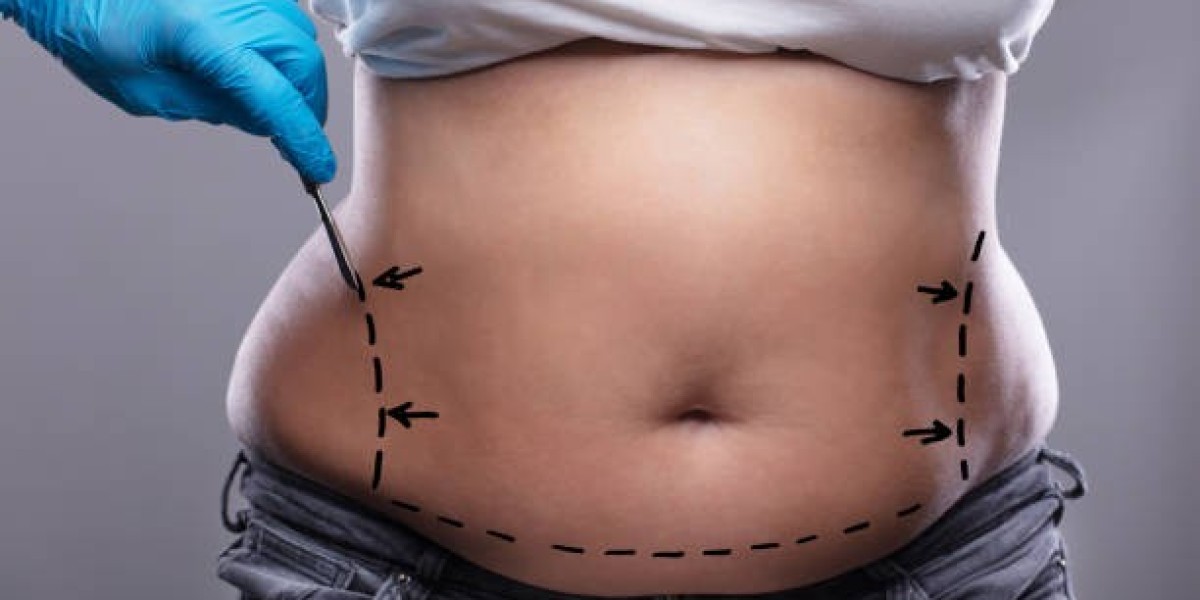 Fast Recovery Liposuction Options in Riyadh