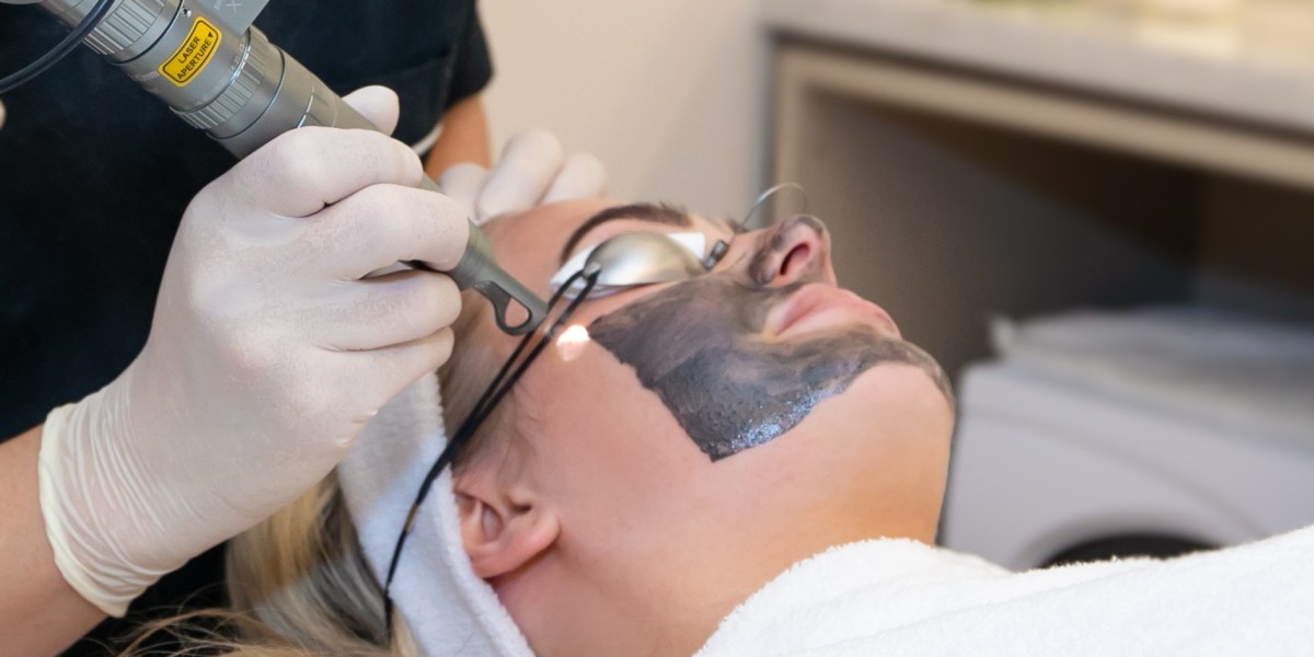 Laser Carbon Peel and LED Therapy: The Perfect