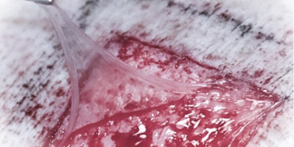 Healing Innovation with Esano Graft