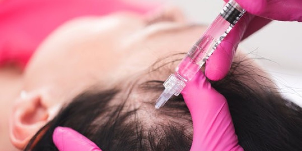 PRP Hair Treatment in Islamabad Pakistan