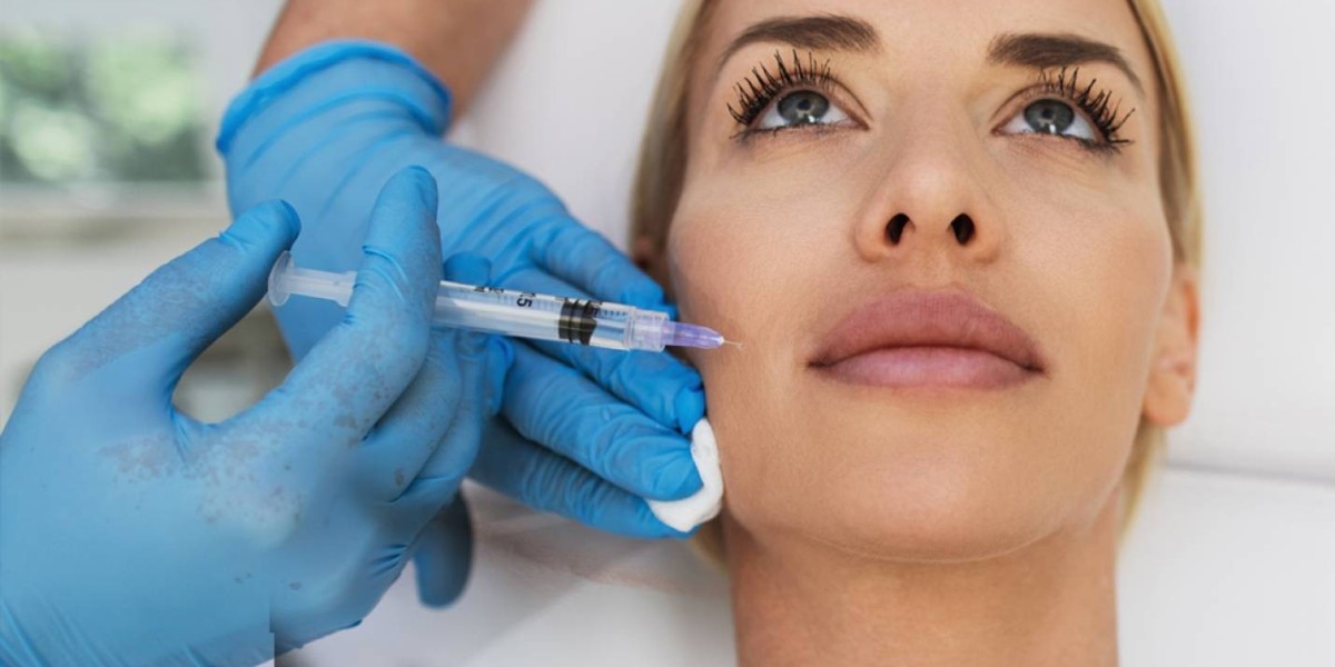 Flaunt Snatched Cheeks with  Dermal Fillers