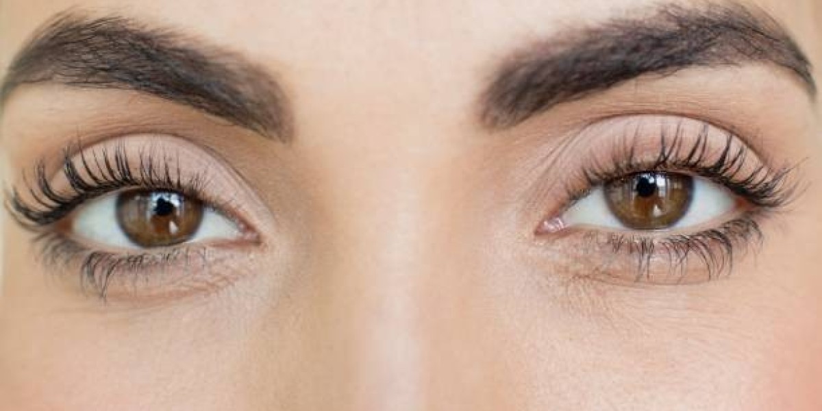 Understanding Upper vs Lower Eyelid Surgery