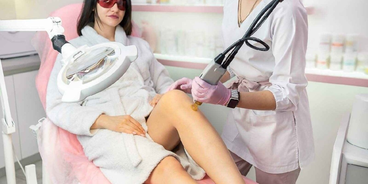 Who Should Try Laser Stretch Marks Treatment in